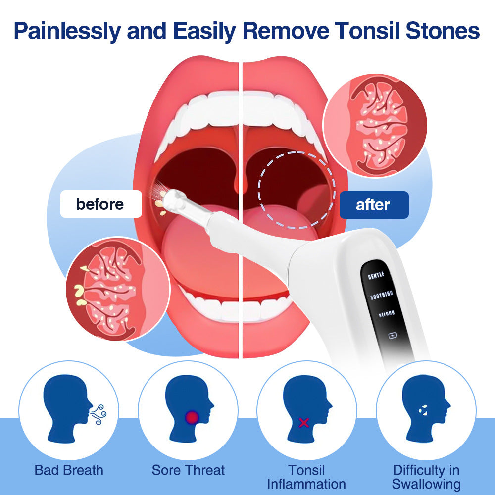 Electric Tonsil Stone Remover