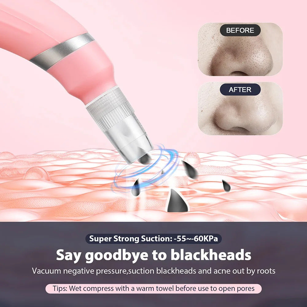Diamond Microdermabrasion Machine